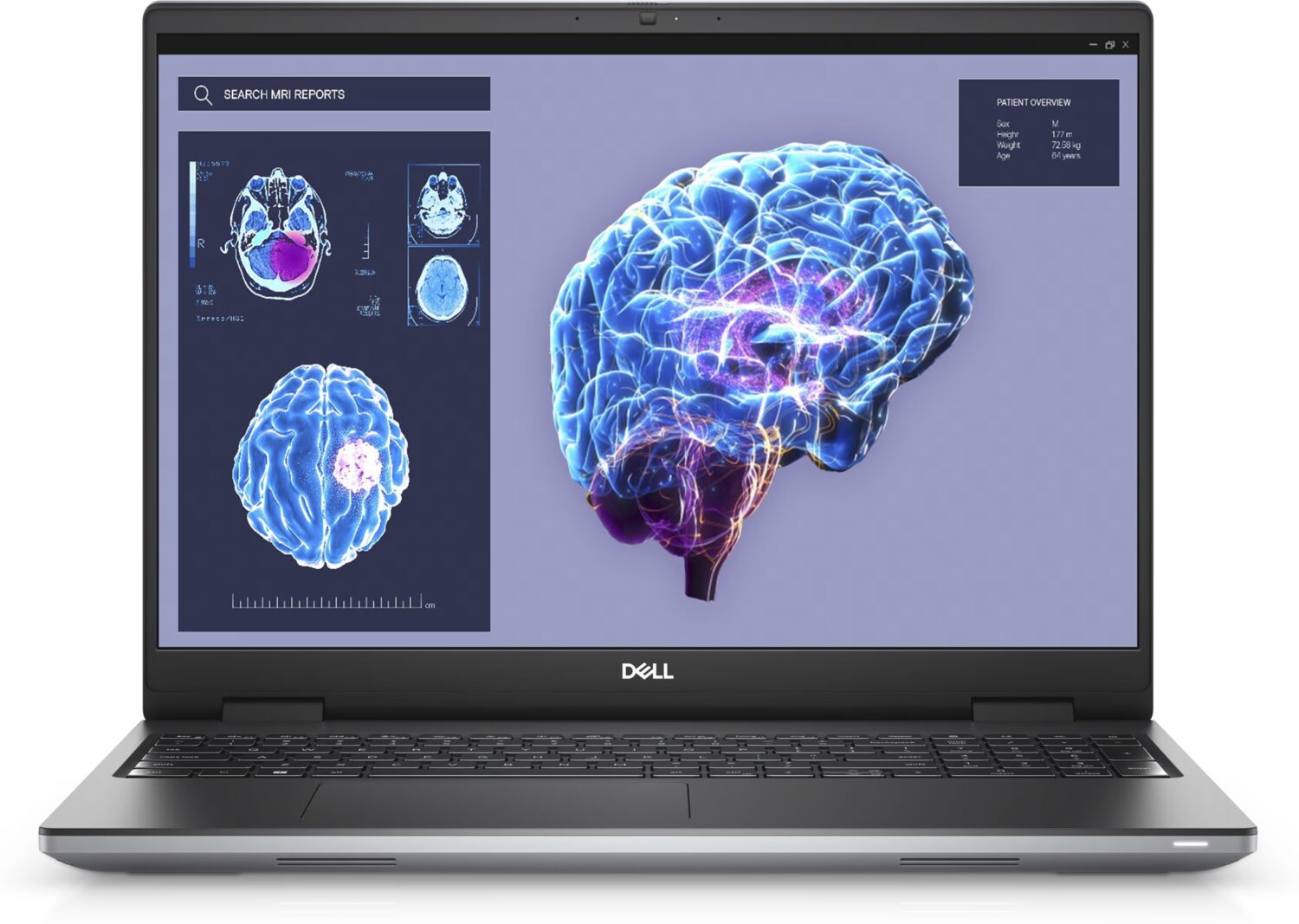 Dell Mobile Precision Workstation 7680 | 16 " | WVA | FHD+ | 1920 x 1200 pixels | Anti-glare | Intel Core i9 | i9-13950HX | 32 GB | Solid-state drive capacity 1000 GB | NVIDIA RTX 2000 Ada | GDDR6 | 8 GB | Windows 11 Pro | 802.11ax | Keyboard language English | Keyboard backlit | Warranty 36 month(s) | Battery warranty 12 month(s)
